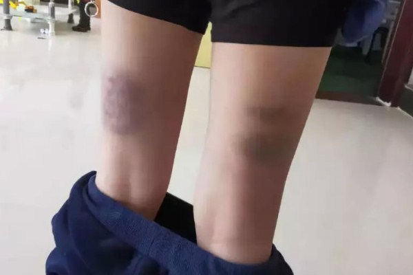 Giáo viên đánh học sinh phạm tội gì?