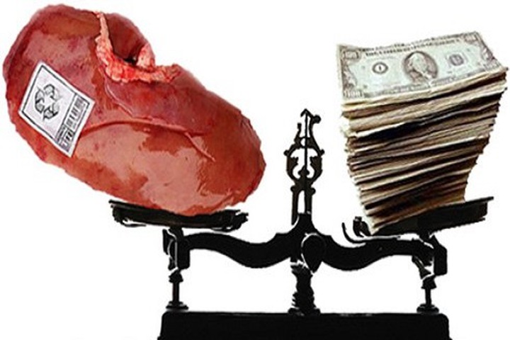 Mua bán thận có bị đi tù?