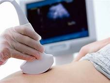 Phá thai để lựa chọn giới tính có vi phạm?