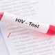 Nhiễm HIV không được làm việc lĩnh vực nào năm 2024?