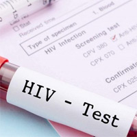 Quân nhân nhiễm HIV có chế độ, quyền lợi gì?