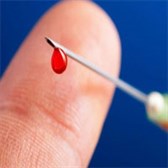 Tội cố ý truyền HIV/AIDS cho người khác bị phạt tù bao nhiêu lâu?