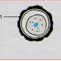 Bào xác của trùng kiết lị xâm nhập vào cơ thể người thông qua con đường nào?