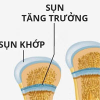 Sụn tăng trưởng có chức năng gì?
