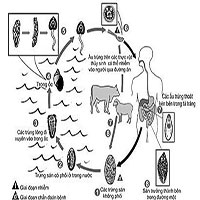 Quyết định 1203/QĐ-BYT 2022 Hướng dẫn chuẩn đoán, điều trị và phòng bệnh sán lá gan lớn