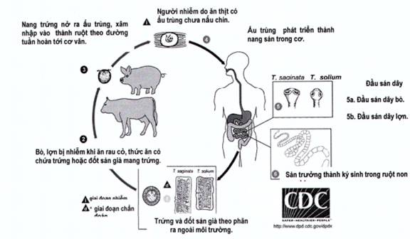 Quyết định số 1202/QĐ-BYT về việc ban hành hướng dẫn chẩn đoán, điều trị và phòng bệnh sán dây 