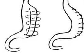 Hướng dẫn chẩn đoán và điều trị bệnh béo phì