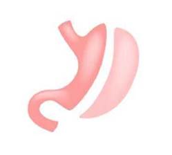 Hướng dẫn chẩn đoán và điều trị bệnh béo phì