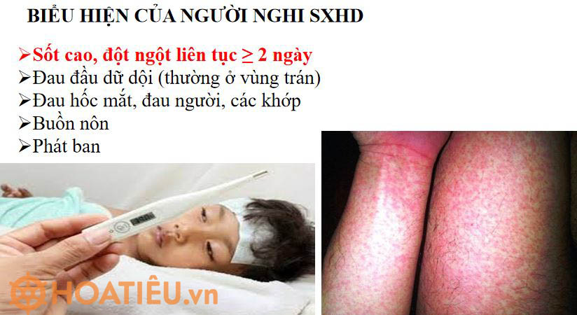 Bài Powepoint phòng chống dịch bệnh sốt xuất huyết trong trường học