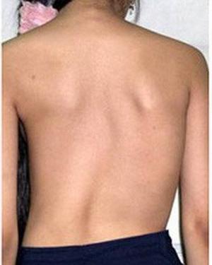  Đề kiểm tra giữa kì 2 KHTN 8 Kết nối tri thức có ma trận