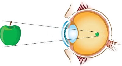 Đáp án cuộc thi chăm sóc mắt và phòng chống suy giảm thị lực ở học sinh tiểu học