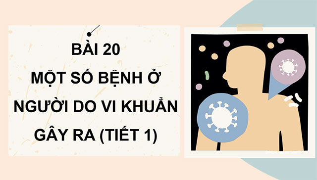 PowerPoint Một số bệnh ở người do vi khuẩn gây ra