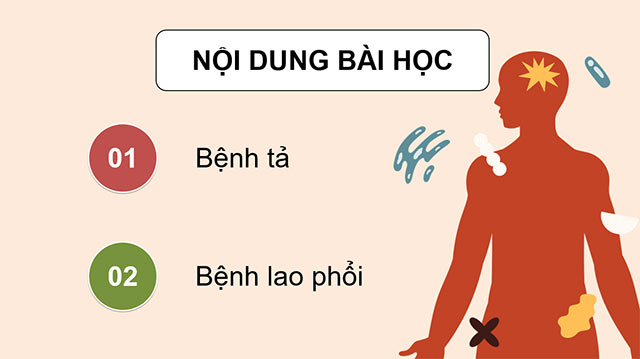 PowerPoint Một số bệnh ở người do vi khuẩn gây ra