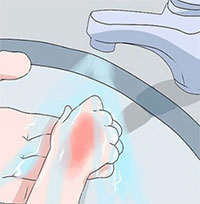 Giáo án kỹ năng sống mầm non: Xử lý khi bị bỏng