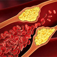 PowerPoint Khoa học tự nhiên 8 Bài 34: Hệ hô hấp ở người