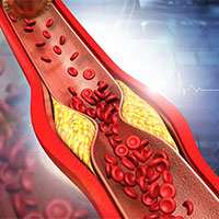 PowerPoint Khoa học tự nhiên 8 Bài 35: Hệ bài tiết ở người